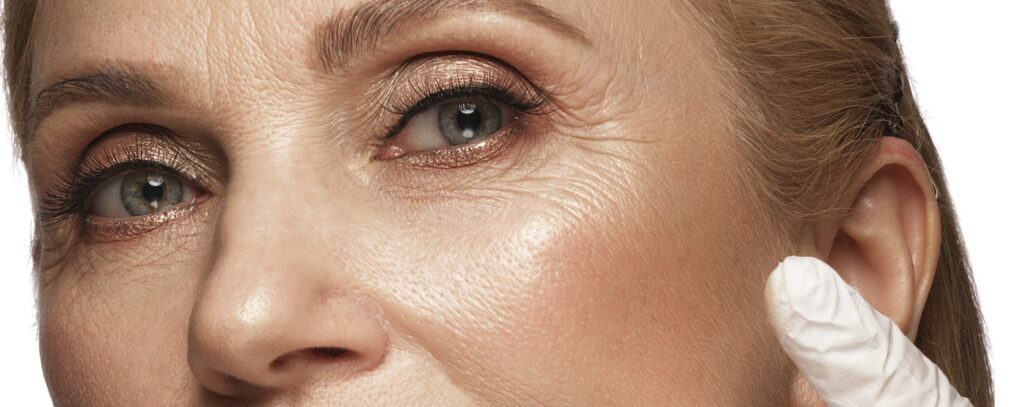 Bioestimuladores de colágeno