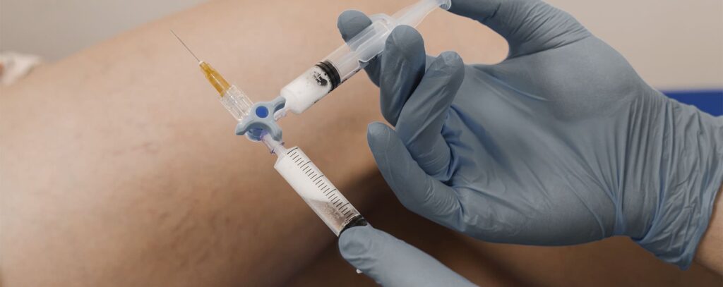 Escleroterapia com espuma