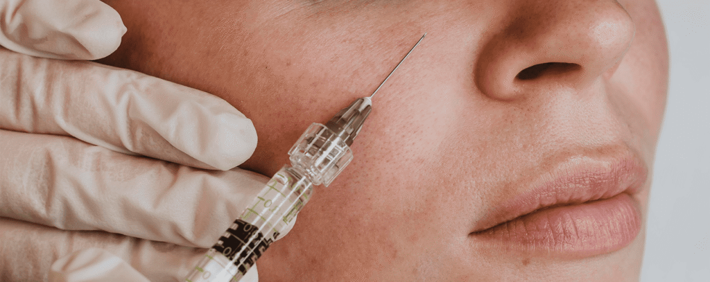 Preenchimento facial